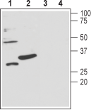 sloβ3/KCNMB3 (extracellular) Blocking Peptide