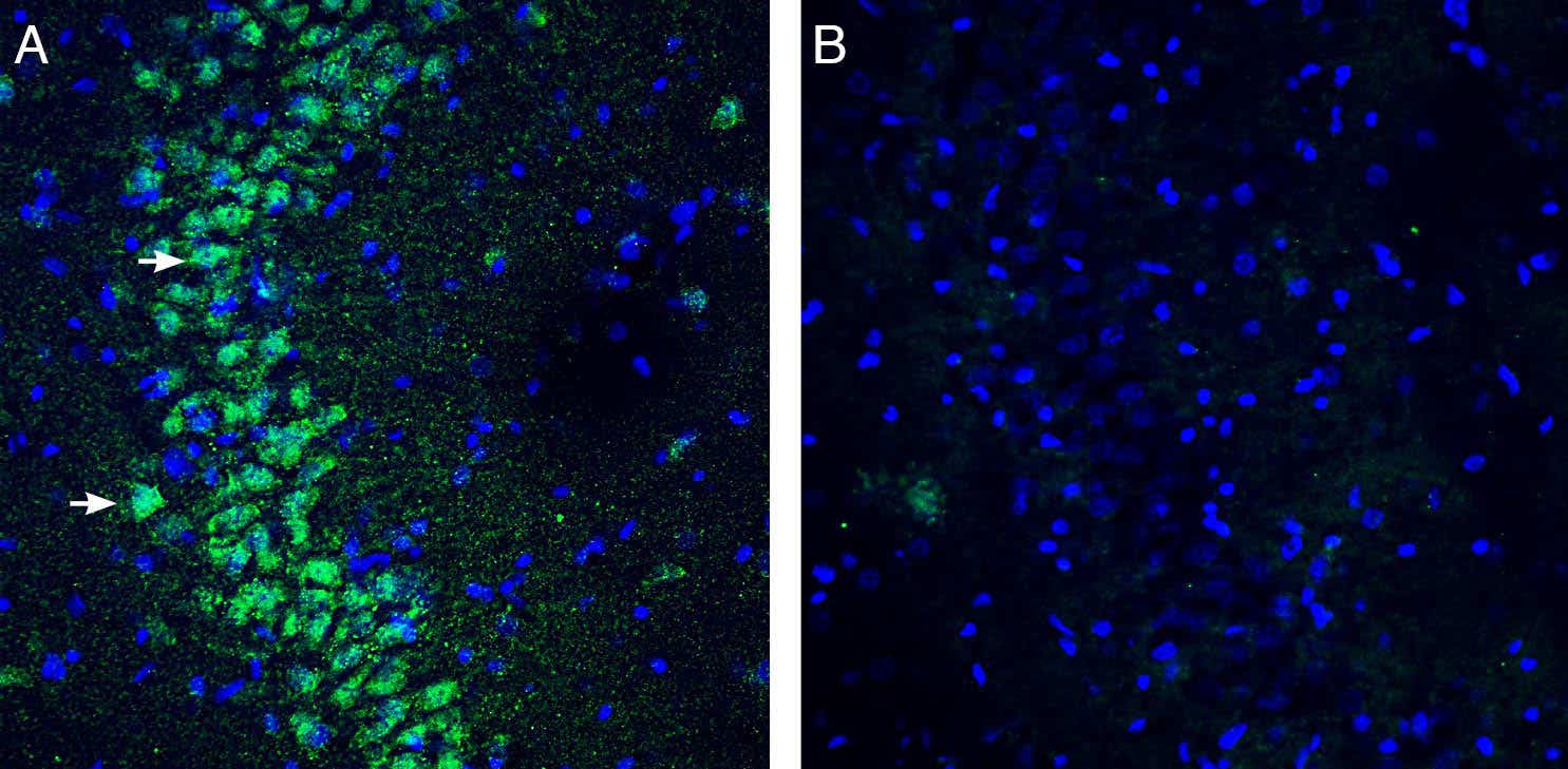 Anti-<em>slo</em>β3 (KCNMB3) (extracellular) Antibody