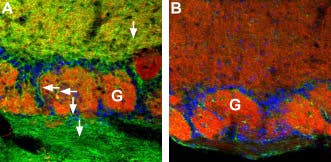 Anti-CNGA4 Antibody