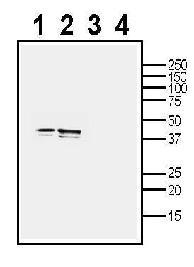 TMEM150C/Tentonin 3 (extracellular) Blocking Peptide