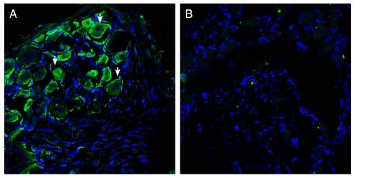 Anti-Piezo2 Antibody