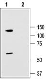 Anti-KCNC3 (K<sub>V</sub>3.3) Antibody