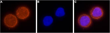 Anti-KCNH1 (EAG-1) Antibody