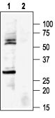 Anti-K<sub>ir</sub>6.1 (KCNJ8) Antibody - Carrier Free