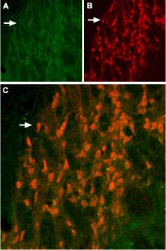 Anti-KCNH6 (erg2) Antibody