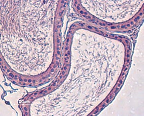 Anti-K<sub>V</sub>12.3 (KCNH4) Antibody