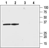 Kvβ2 Blocking Peptide