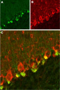 Anti-K<sub>V</sub>β2 Antibody