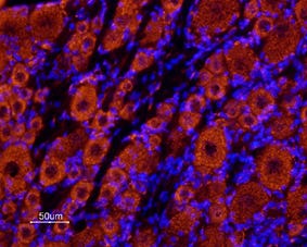 Anti-KCNK18 (TRESK) (extracellular) Antibody