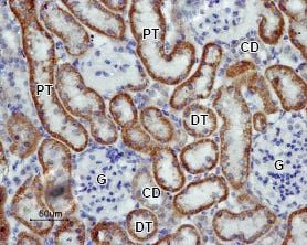 Anti-K<sub>ir</sub>5.1 Antibody