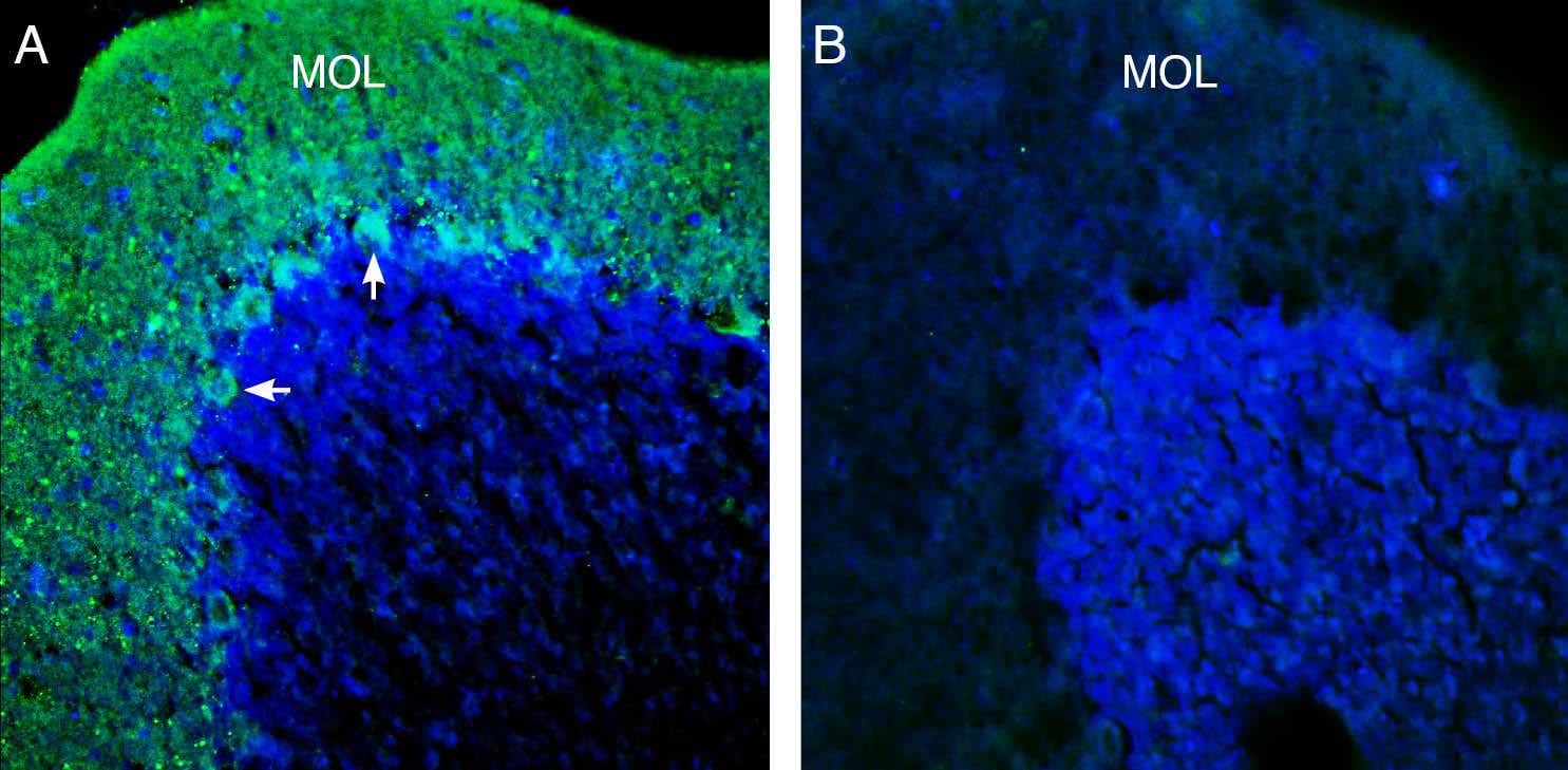 Anti-KCNT1 (Slack) Antibody