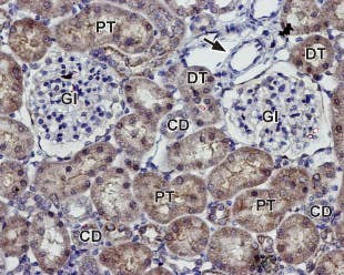 Anti-K<sub>ir</sub>7.1 (extracellular) Antibody