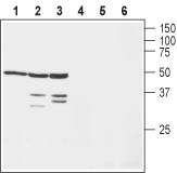 Anti-K<sub>V</sub>β1 Antibody