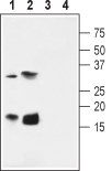 KCNE4/MiRP3 Blocking Peptide