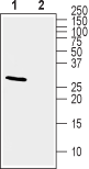 KChIP2 Blocking Peptide
