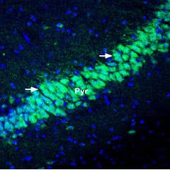 Anti-KChIP2 Antibody