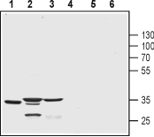 Anti-KChIP3 (CSEN, DREAM) Antibody - Carrier Free