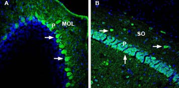 Anti-DPP10 (extracellular) Antibody