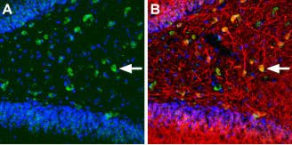 Anti-KCNQ5 Antibody