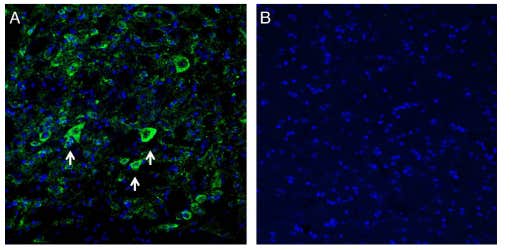 Anti-K<sub>ir</sub>2.1/KCNJ2 (extracellular) Antibody