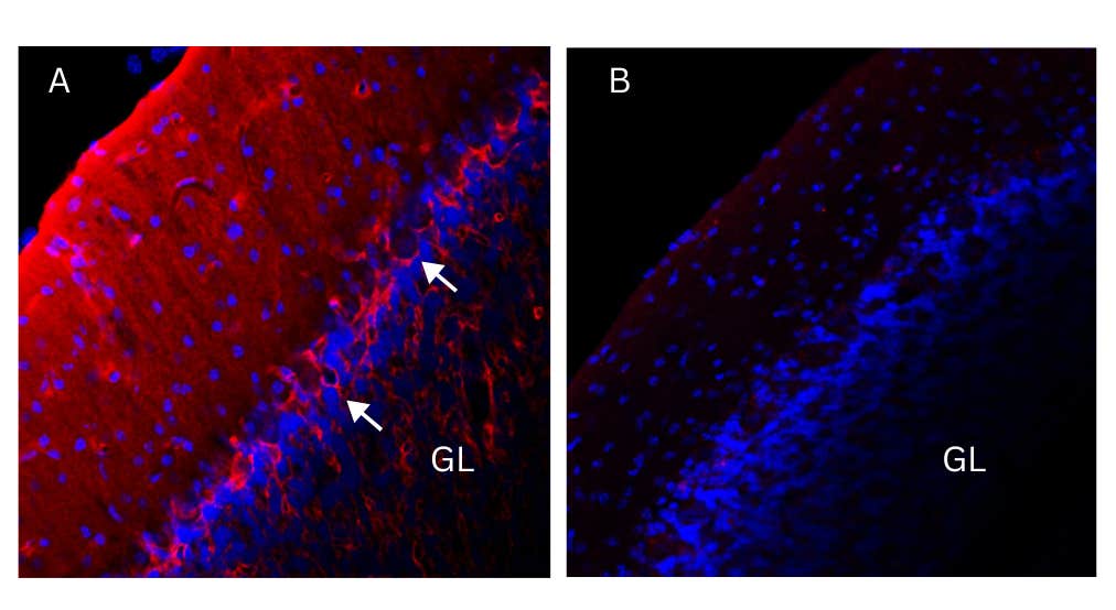 Anti-K<sub>V</sub>1.1 (KCNA1) (extracellular) Antibody