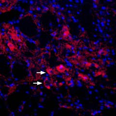 Anti-KCNQ4 Antibody