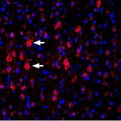Anti-K<sub>V</sub>1.4 (extracellular) Antibody