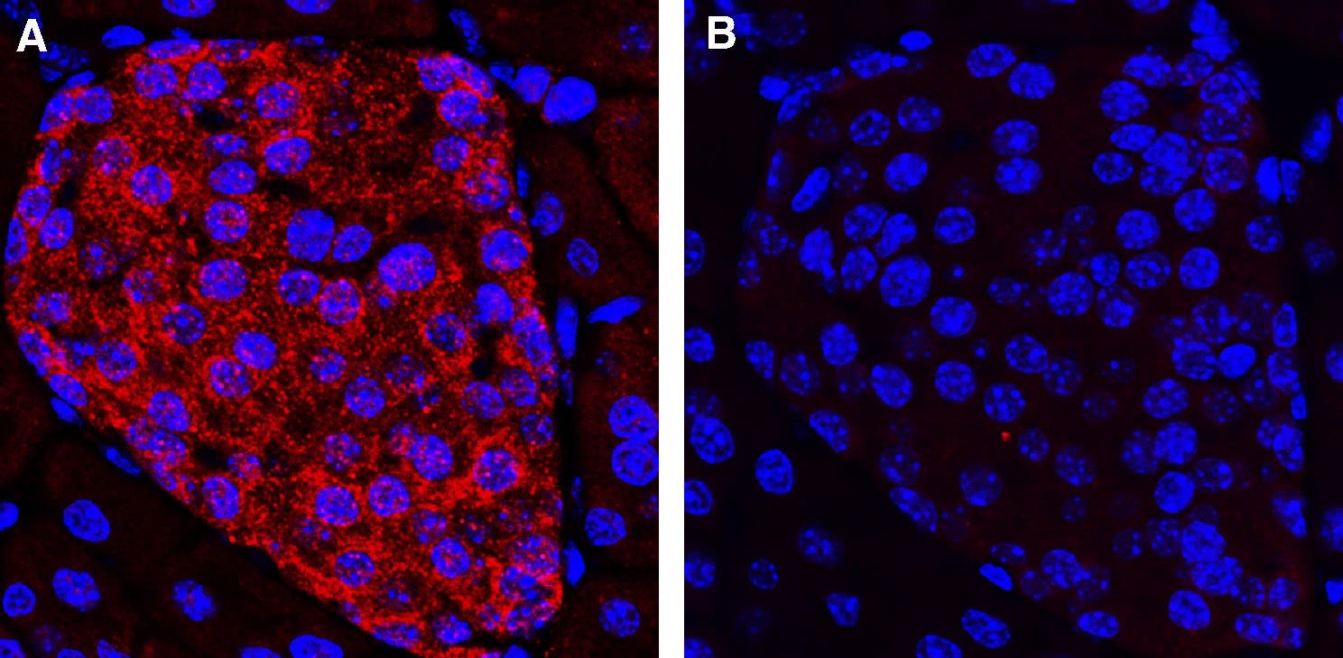 Anti-KCNK16 (TALK-1) (extracellular) Antibody