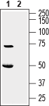 KCNK16/TALK-1 (extracellular) Blocking Peptide