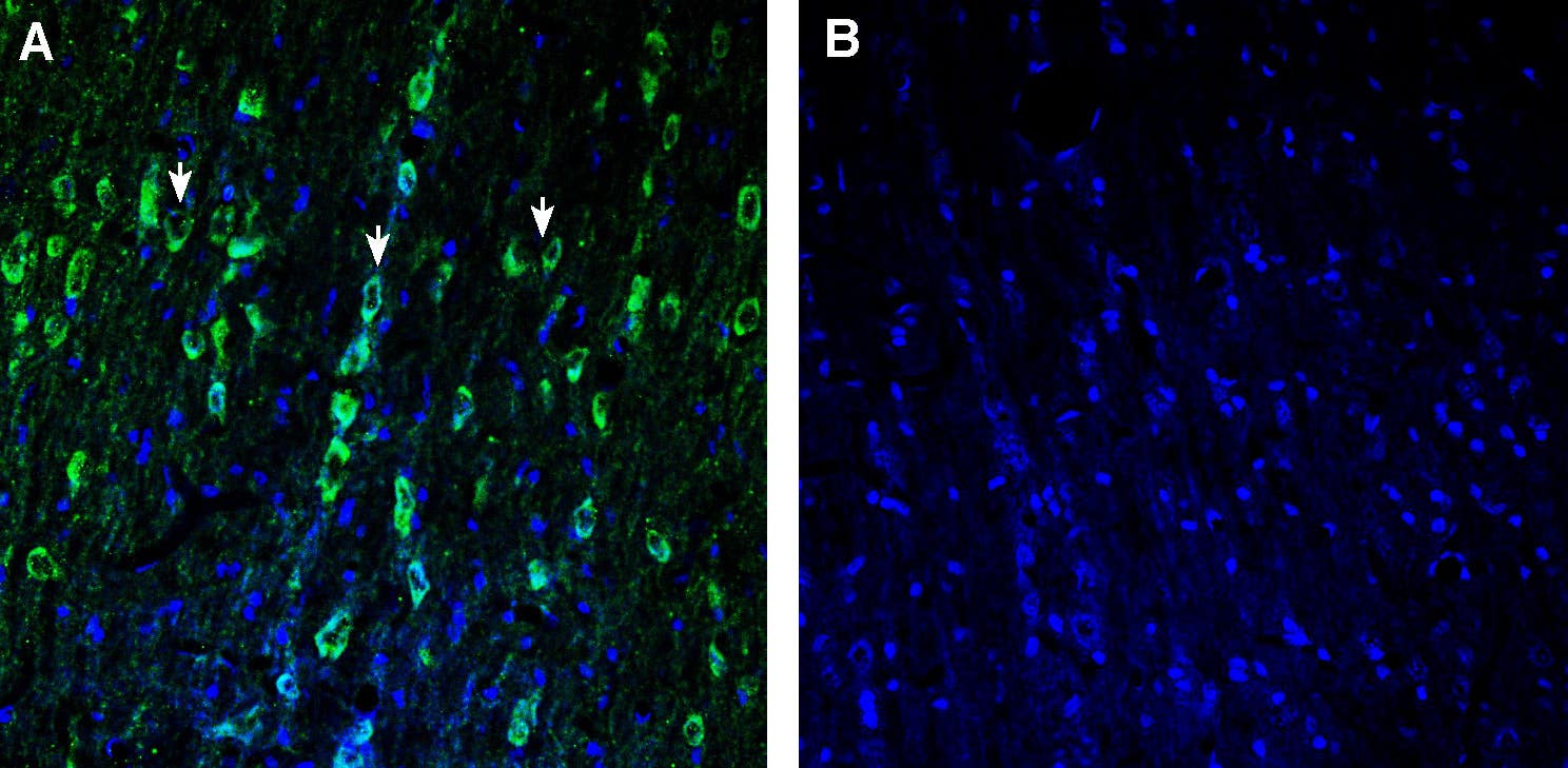 Anti-TMEM175 Antibody