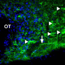 Anti-P2X1 Receptor Antibody