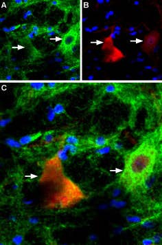 Anti-P2X4 Receptor Antibody