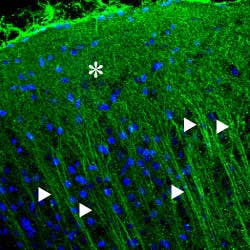 Anti-P2X2 Receptor Antibody