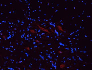 Anti-P2X5 Receptor Antibody