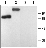 P2Y1 Receptor Blocking Peptide
