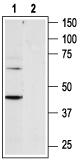 P2Y6 Receptor Blocking Peptide