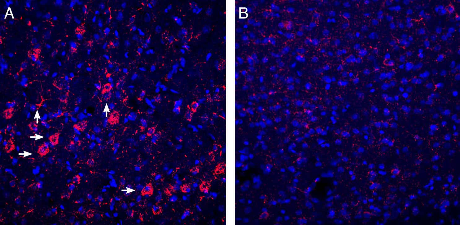 Anti-P2Y6 Receptor Antibody