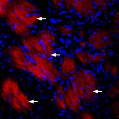 Anti-P2Y12 Receptor-ATTO Fluor-594 Antibody
