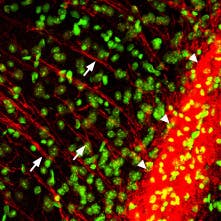 Anti-P2Y12 Receptor Antibody