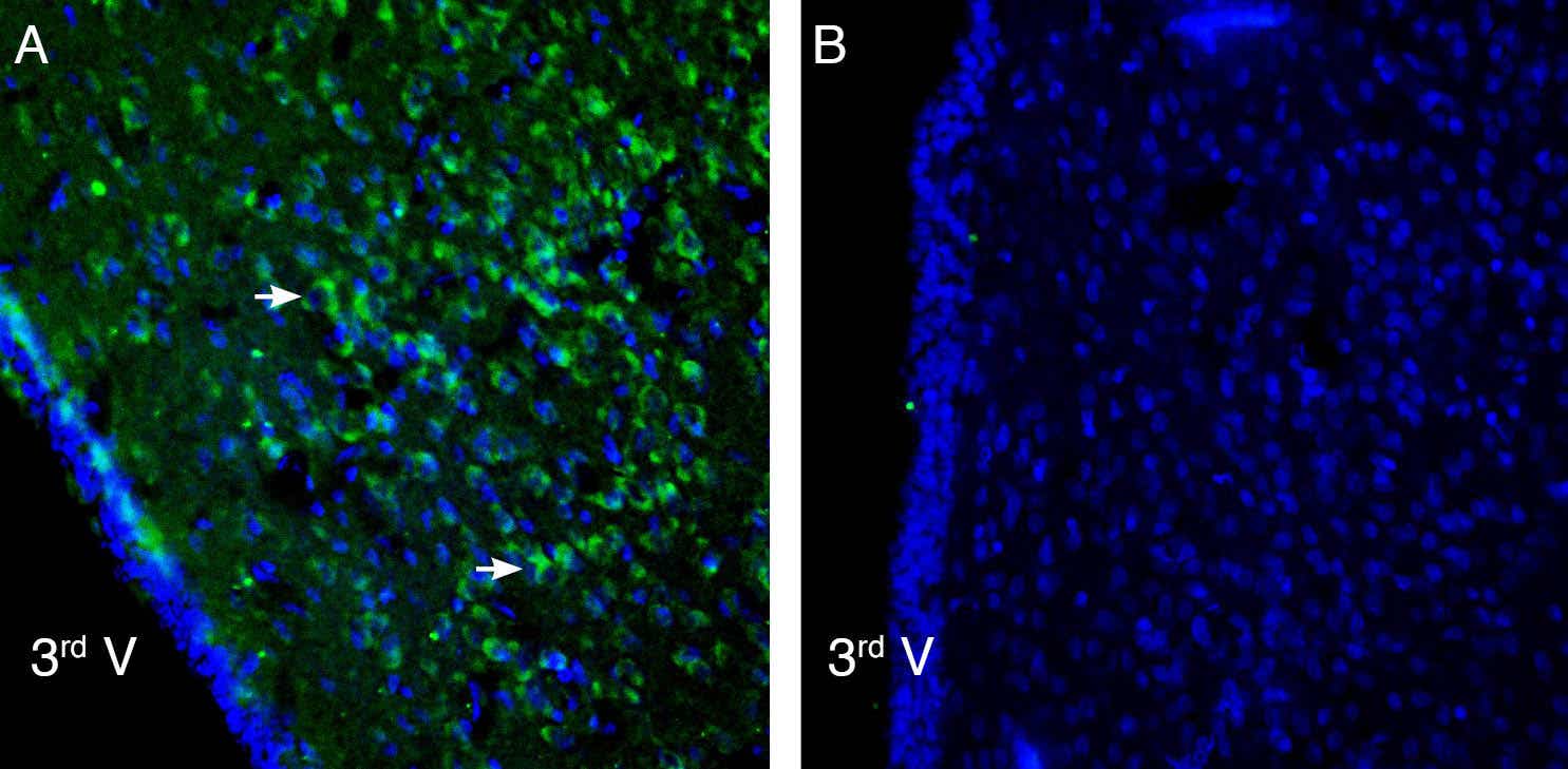 Anti-P2X6 Receptor Antibody