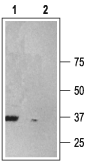 P2X6 Receptor Blocking Peptide