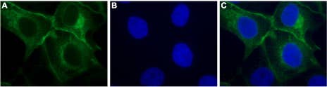 Anti-Human P2Y11 Receptor Antibody