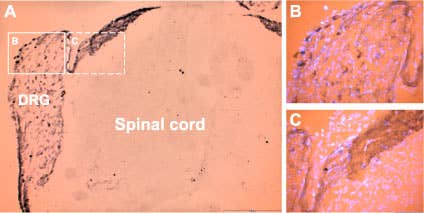 Anti-P2X3 Receptor Antibody
