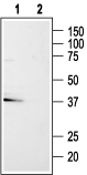 P2Y13 Receptor Blocking Peptide