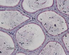 Anti-P2Y13 Receptor Antibody