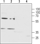P2Y12 Receptor (extracellular) Blocking Peptide