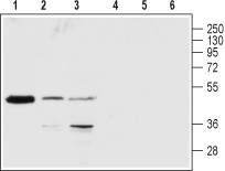 P2Y1 Receptor (extracellular) Blocking Peptide