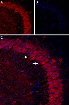 Anti-P2Y1 Receptor (extracellular) Antibody