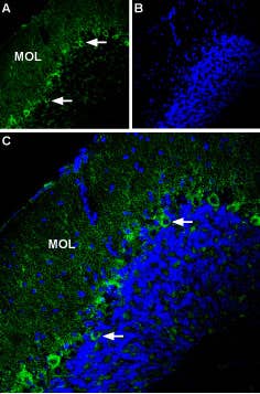 Anti-P2X1 Receptor (extracellular) Antibody