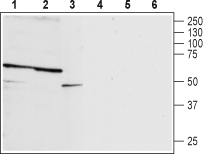 Anti-P2X2 Receptor (extracellular) Antibody